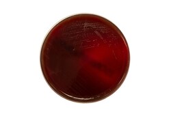 Thermo Scientific Iso-Sensitest Agar with Horse Blood and 20mg/L NAD Iso-Sensitest Agar with Horse Blood and 20mg/L NAD | Buy Online | Thermo Scientific&trade; | Fisher Scientific